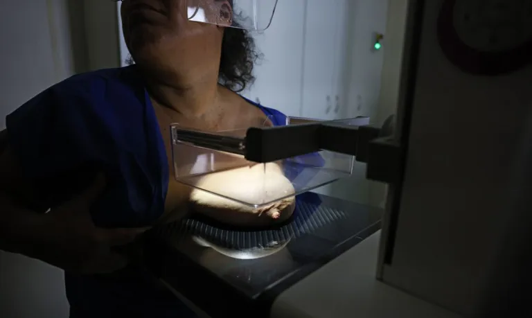 Vigitel: 92% das brasileiras entre 50 e 69 anos fizeram mamografia