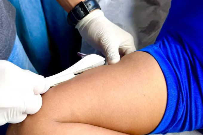 Secretaria Municipal de Saúde realiza ação para implante de contraceptivo Implanon em mulheres quilombolas