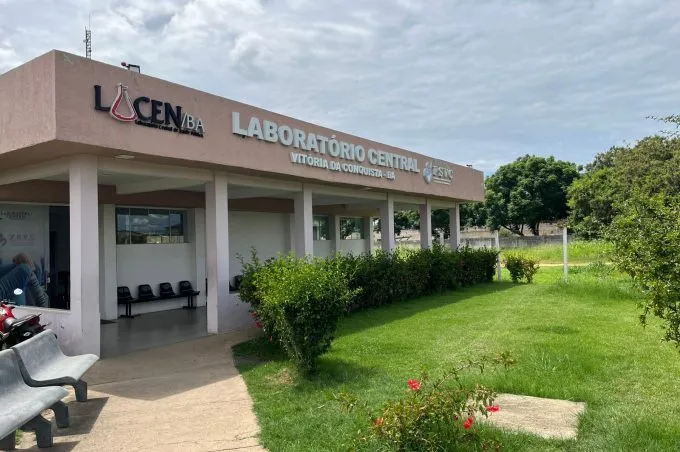 Laboratório Central Municipal fortalece diagnóstico em saúde em Vitória da Conquista